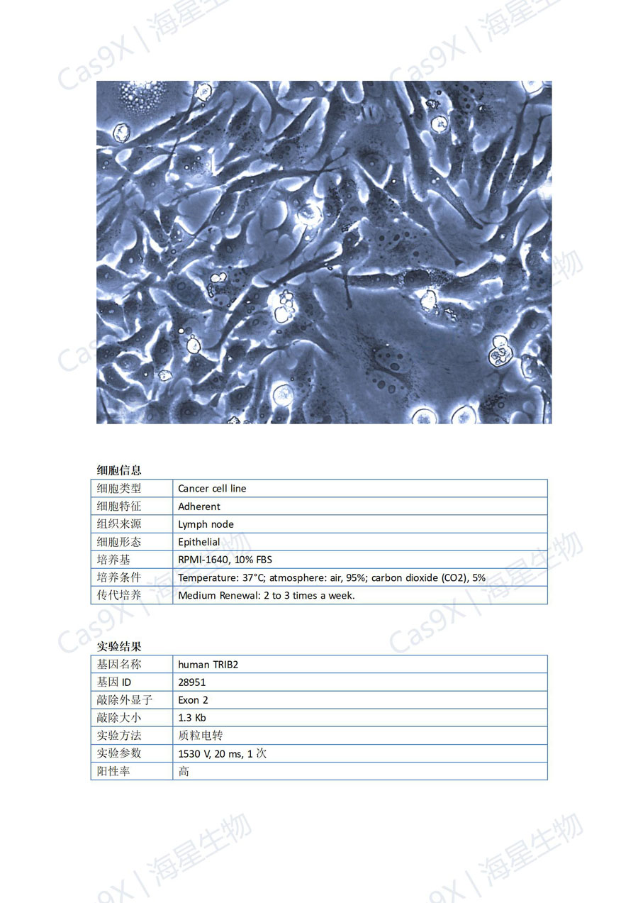 人胃癌细胞(HGC-27 )TRIB2_01.jpg
