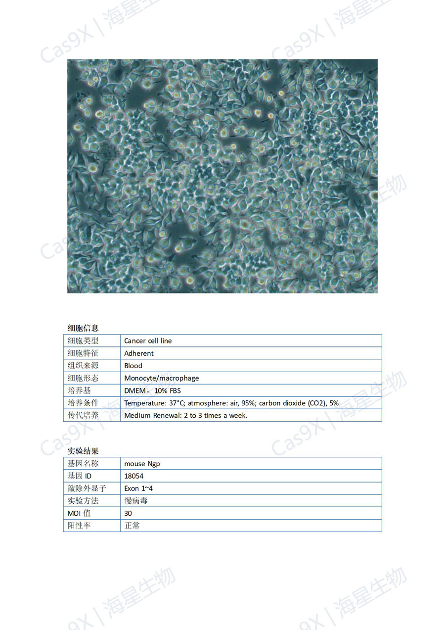 小鼠单核巨噬细胞白血病（RAW264.7 ）Ngp_01.jpg