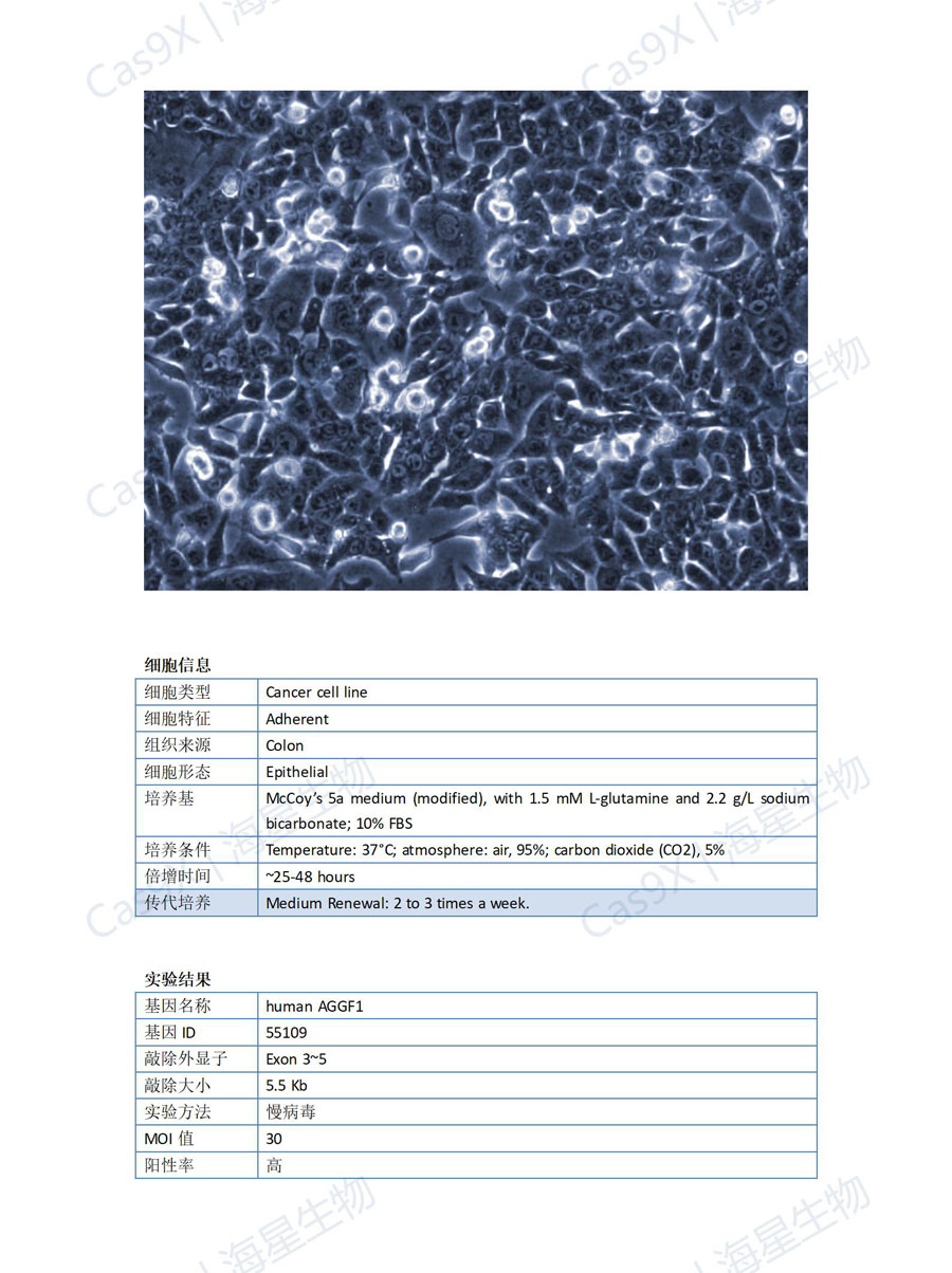 人结肠癌细胞(HCT116 )AGGF1.jpg