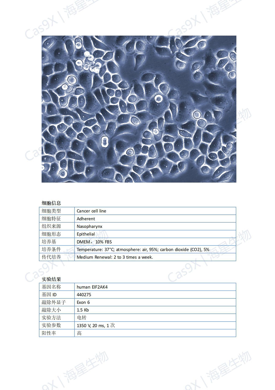 人鼻咽癌细胞(C666-1 )EIF2AK4_01.jpg