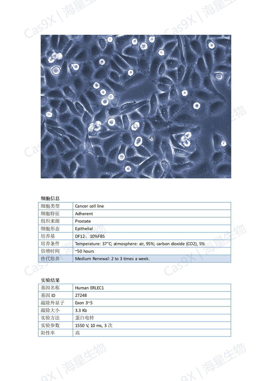 人前列腺癌细胞PC3（Human ERLEC1）_01.jpg