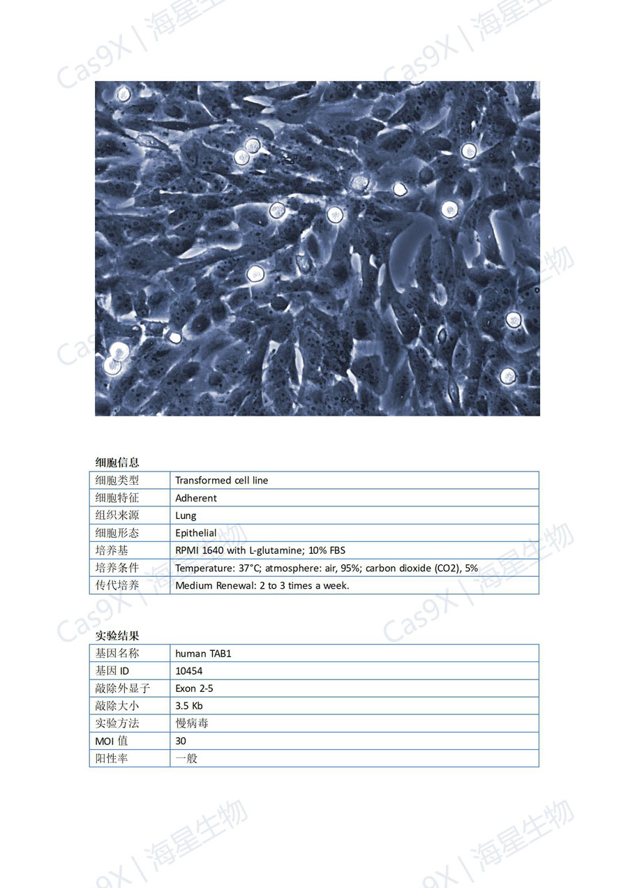 人正常肺上皮细胞（BEAS-2B ）TAB1_01.jpg