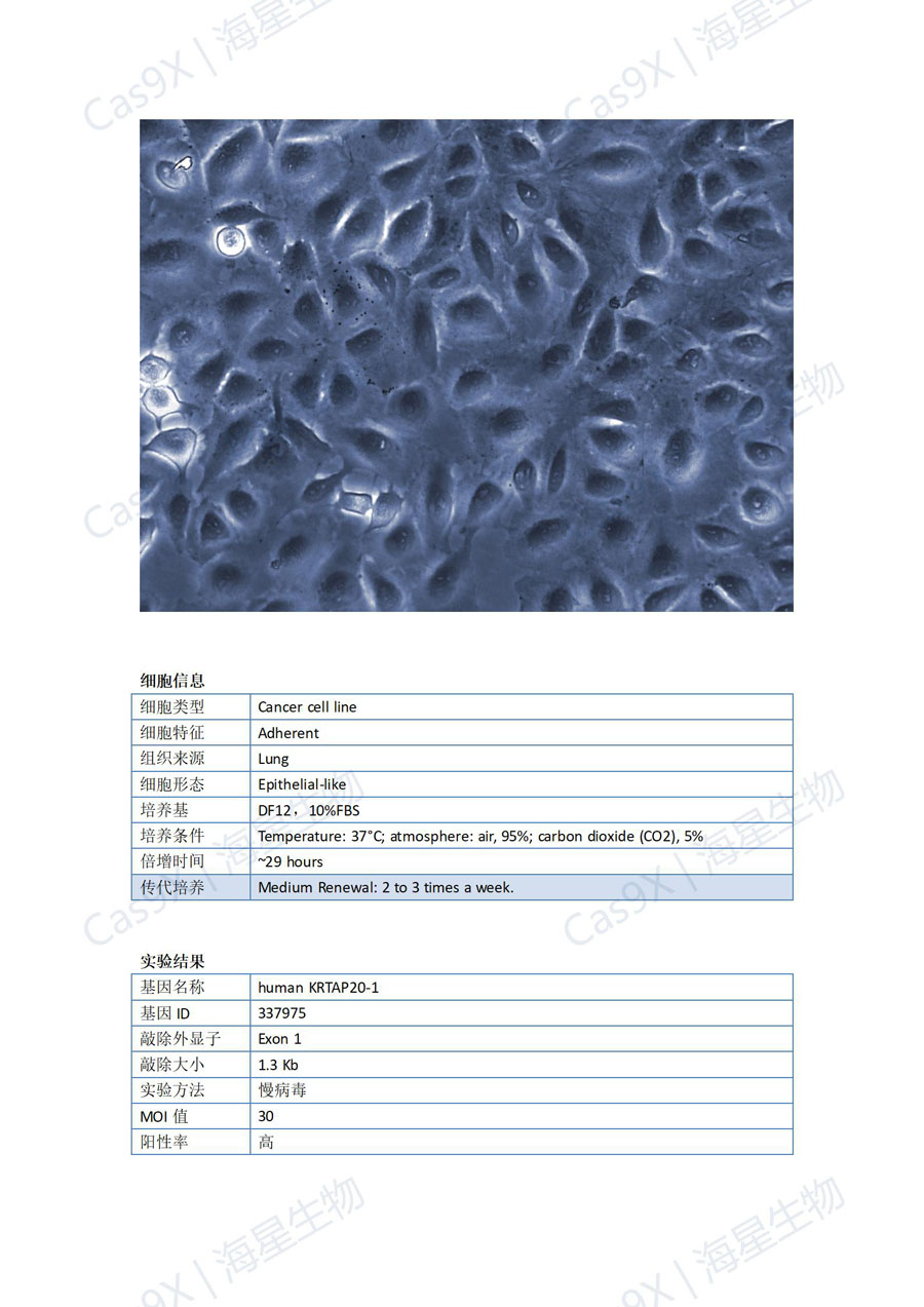 人肺癌细胞（A549 ）KRTAP20-1_01.jpg