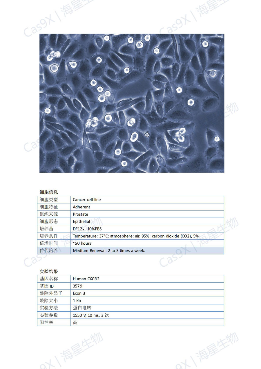 人前列腺癌细胞（PC3 ）CXCR2_01.jpg