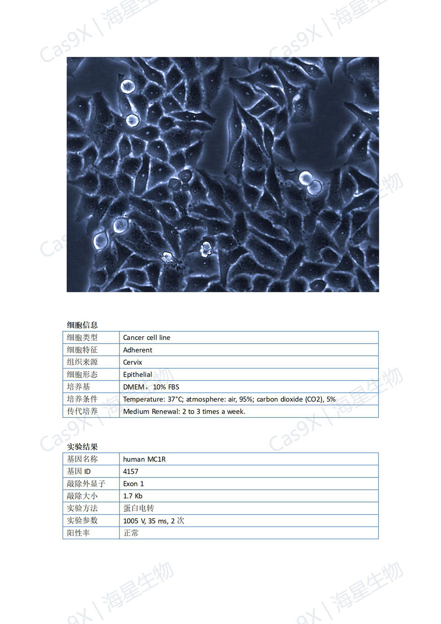 人宫颈癌细胞(HeLa)MC1R_01.jpg