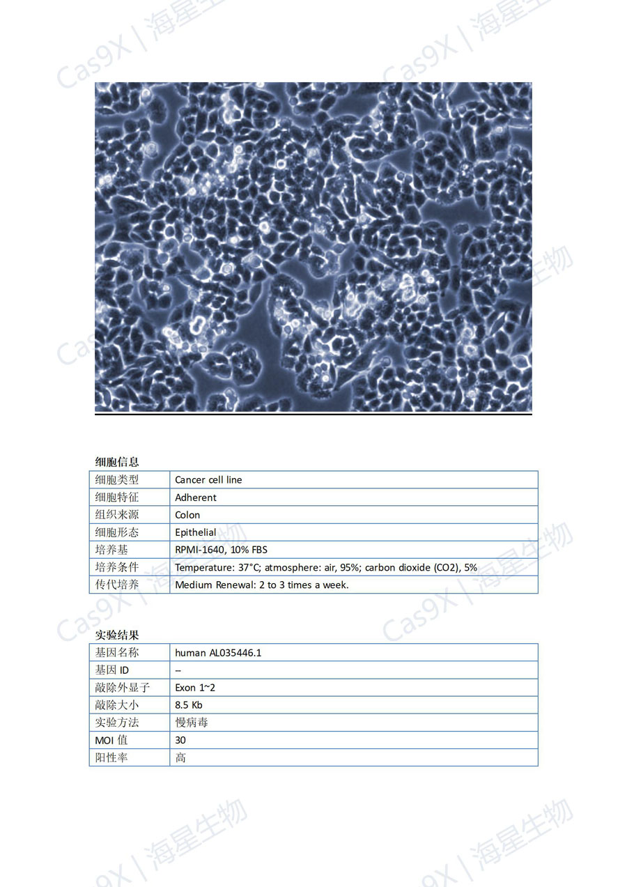 人结肠癌细胞（HCT-8 ）AL035446.1_01.jpg