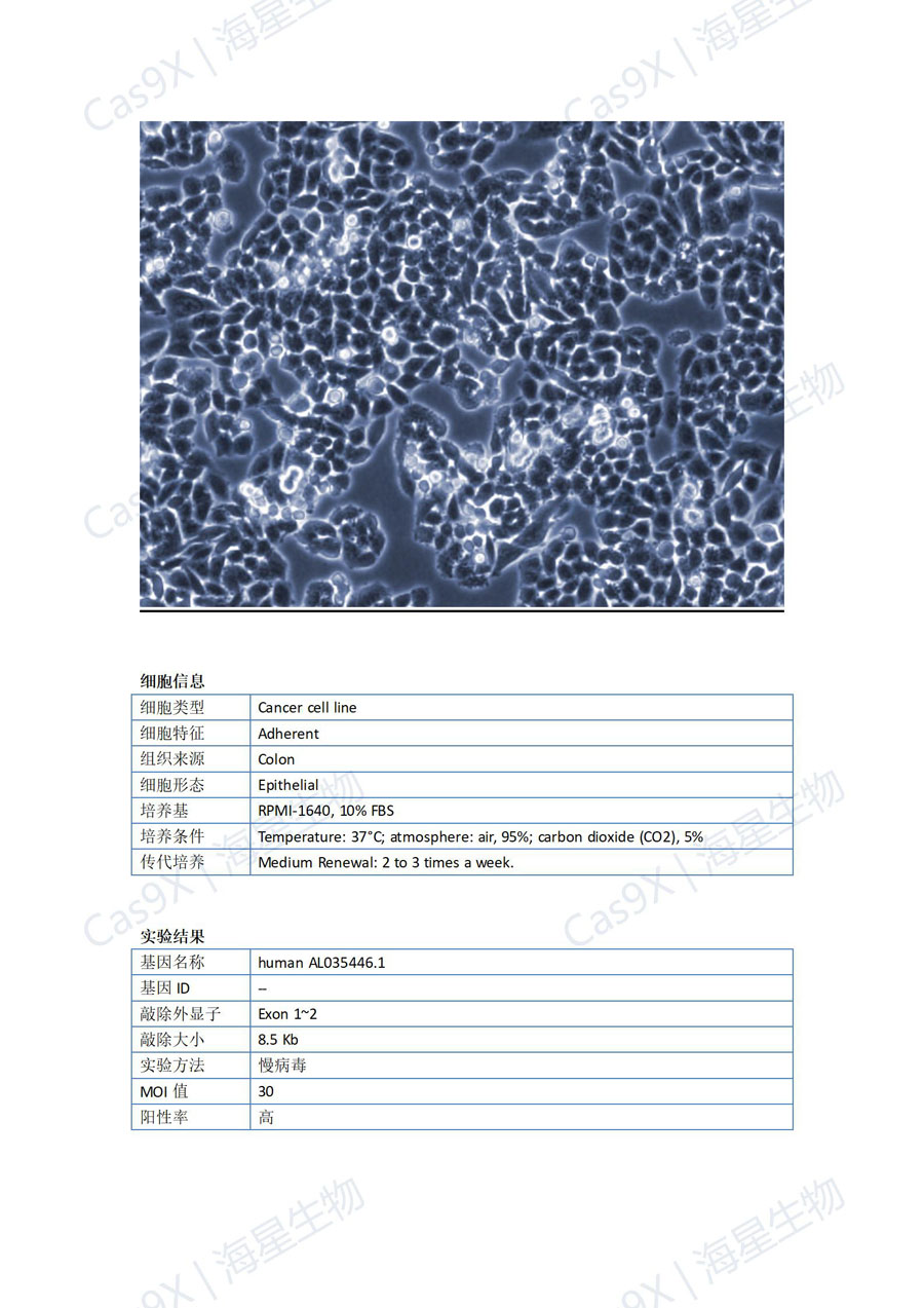 人结肠癌细胞（HCT-8 ）AL035446.1_01.jpg