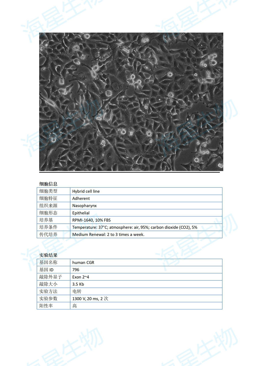 人鼻咽癌细胞(CNE2Z )CGR.jpg