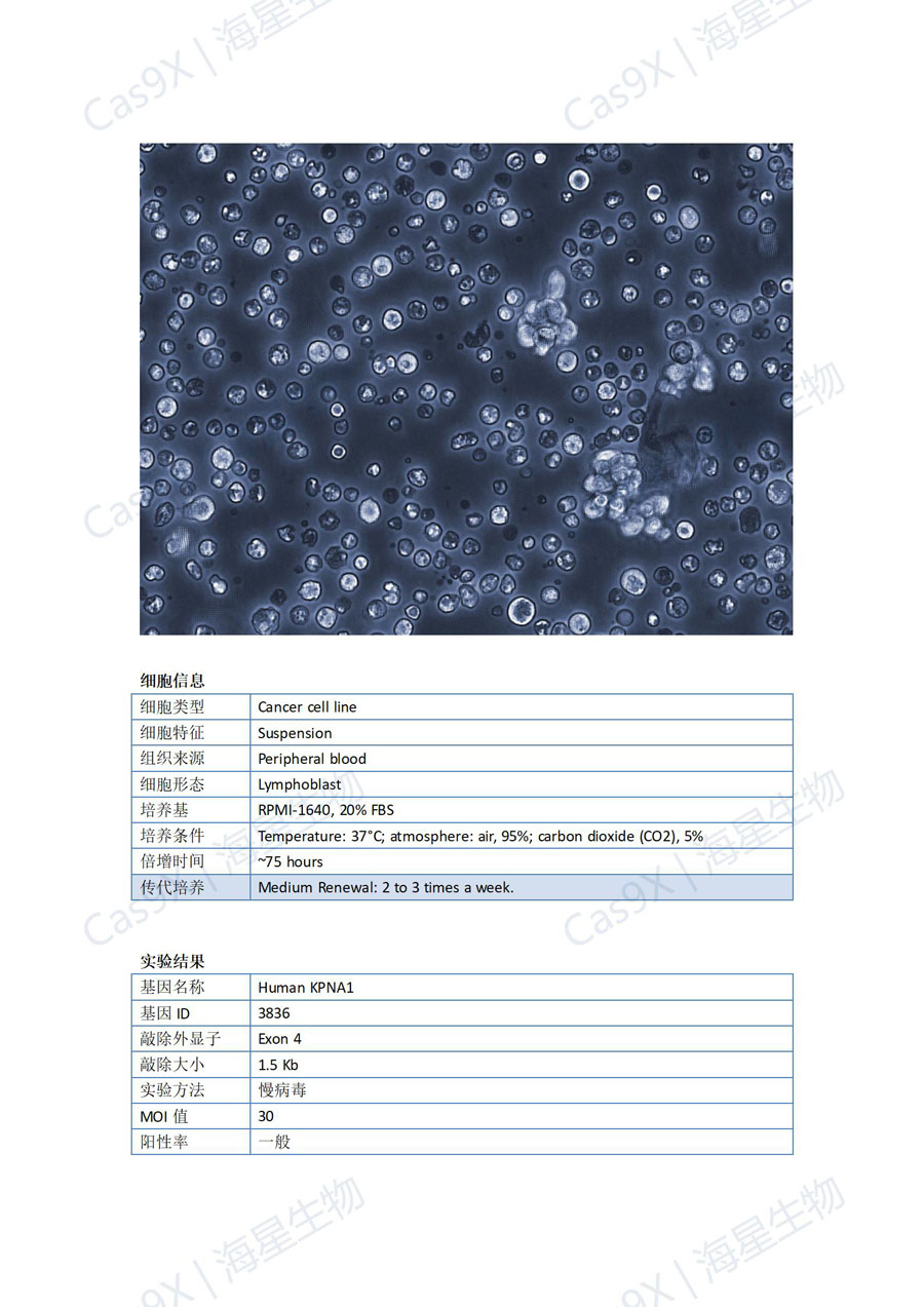 人T淋巴细胞白血病细胞（HuT78  ）KPNA1_01.jpg