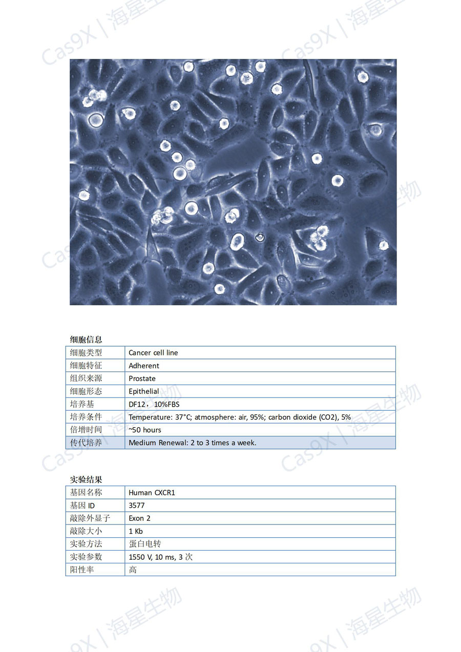 人前列腺癌细胞（PC3 ）CXCR1_01.jpg