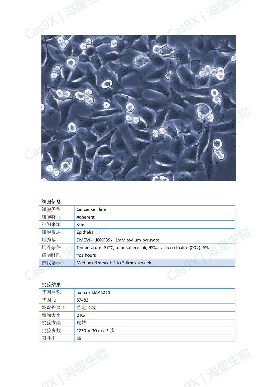 人恶性黑素瘤细胞(A375 )KIAA1211_01.jpg