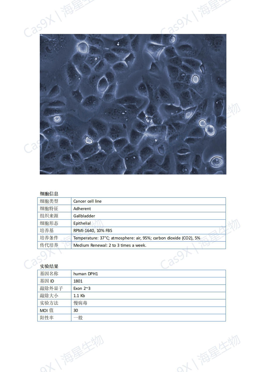 人胆管癌细胞(HuCCT1 )DPH1_01.jpg