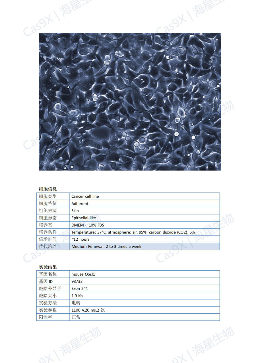 小鼠黑色素瘤细胞(B16 )Obsl1_01.jpg