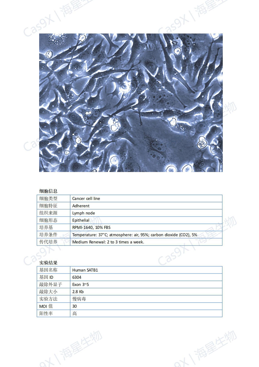 人胃癌细胞(HGC-27 )SATB1_01.jpg