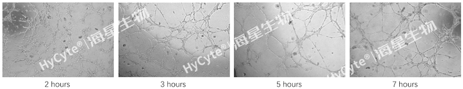 HUVEC细胞系血管形成能力验证.jpg