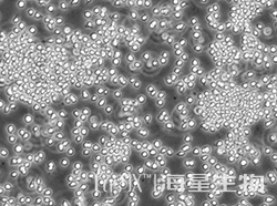 人B淋巴瘤细胞（SU-DHL-4）