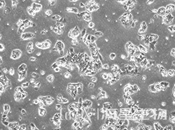 人永生化肝细胞(C3A)