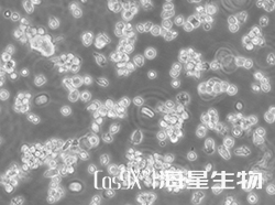 人外周血B淋巴细胞(AHH-1)