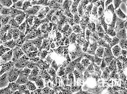 人整合SV40基因的乳腺上皮细胞(HBL-100)