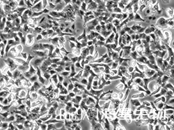 大鼠肾上腺嗜铬细胞瘤细胞(低分化)(PC-12)