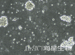 人永生化B淋巴母细胞(B-LCLs)