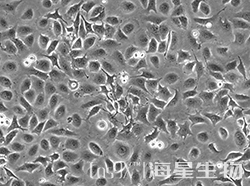 人永生化鼻咽上皮细胞(NP69)