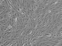 人视网膜色素上皮细胞（ARPE-19）