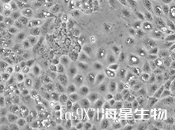 人肝母细胞瘤细胞(HuH-6)