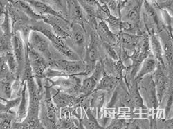 人肾癌细胞(A498)