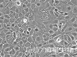 人食道鳞状癌细胞(KYSE410)