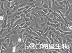 小鼠主动脉血管平滑肌细胞(MOVAS-1)
