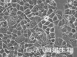 人乳腺管癌细胞（T-47D)