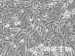 HyCyte® 永生化人脐带间充质干细胞（IH UCMSCs）(仅供科研使用)