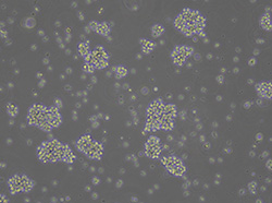 人T淋巴细胞白血病细胞Jurkat-Cas9(TCH-C225-M01)