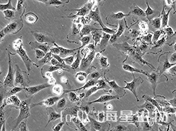 人肾细胞腺癌细胞（786-O）