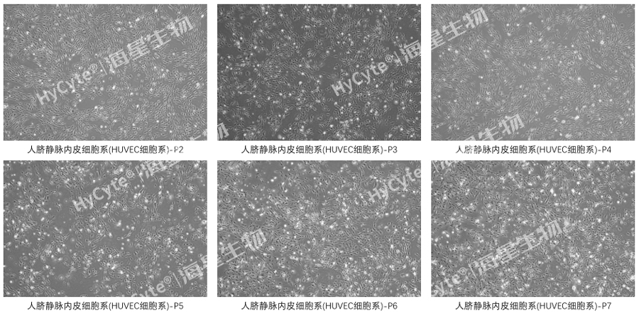 HUVEC细胞系-传代图片.jpg