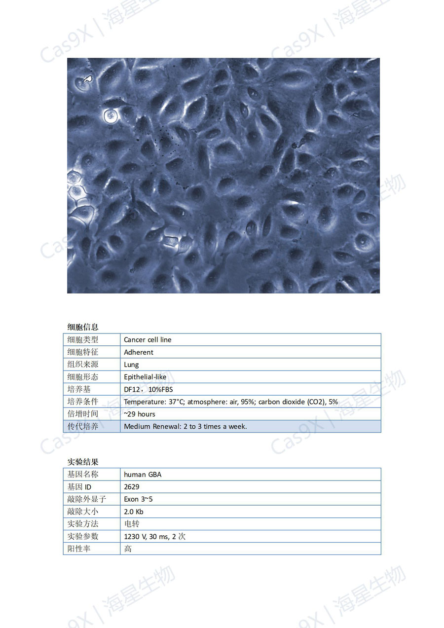 人肺癌细胞（A549 ）GBA_01.jpg